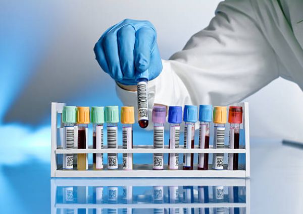 Certified Best Pathology Lab In Dwarka Delhi Zohan Labs   Pathology Lab In Delhi 